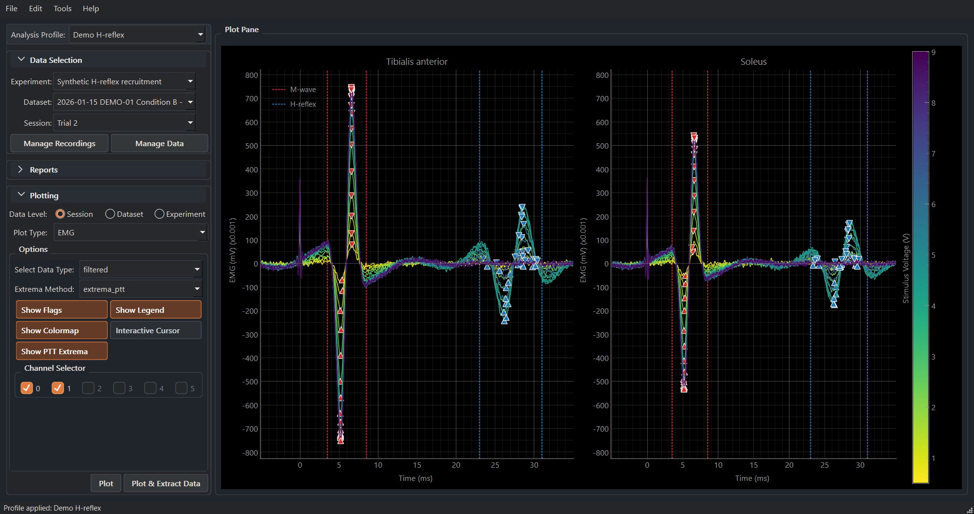 Synthetic H-reflex EMG overlay in MonStim Analyzer.