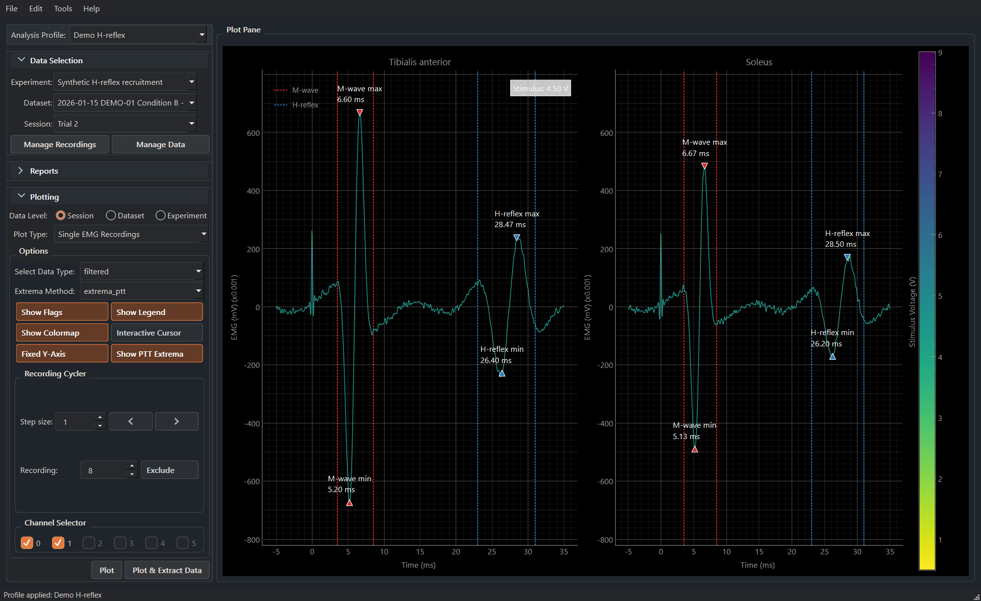 Synthetic individual H-reflex recording in MonStim Analyzer.
